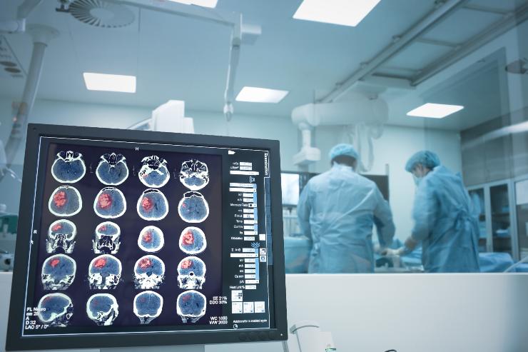 Sala operatoria neurologia - Fonte AdobeStock