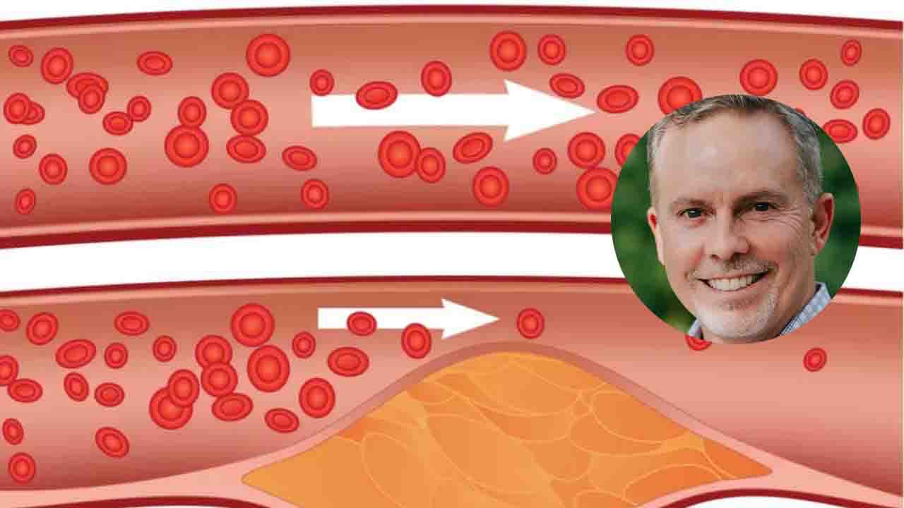 Colesterolo alto, un cucchiaio tutte le mattine a digiuno, e il tuo sangue sarà fluidissimo