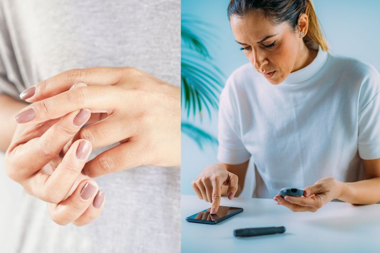 Donna con diabete e problemi alle mani - Fonte AdobeStock