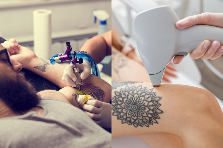 Seduta tatuaggio e rimozione - Fonte AdobeStock