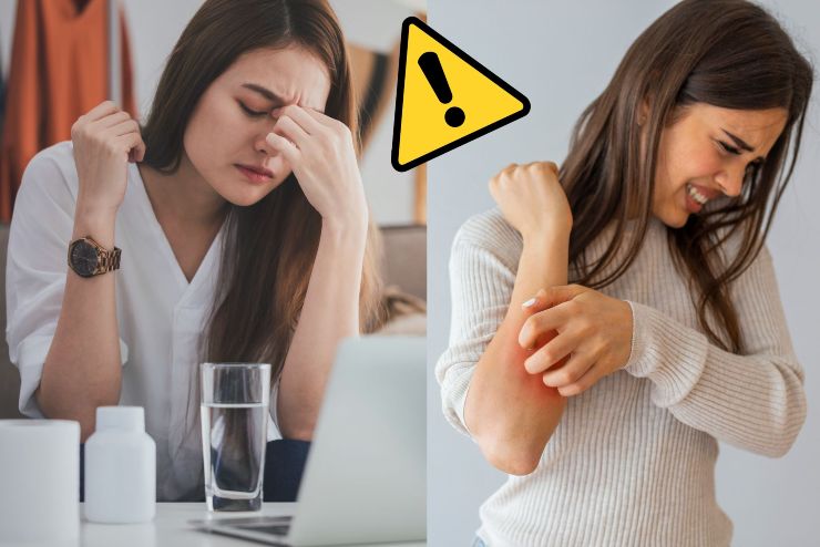 Stress e psoriasi - Fonte AdobeStock