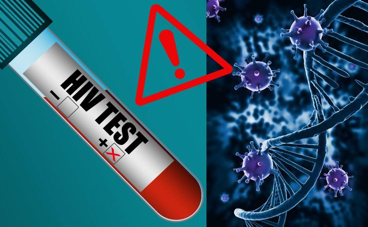 Test HIV - Fonte AdobeStock