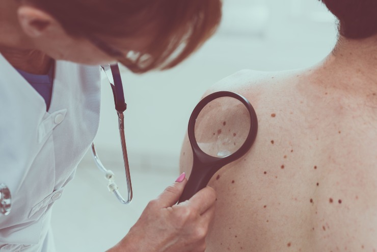 Visita dermatologica - Fonte AdobeStock