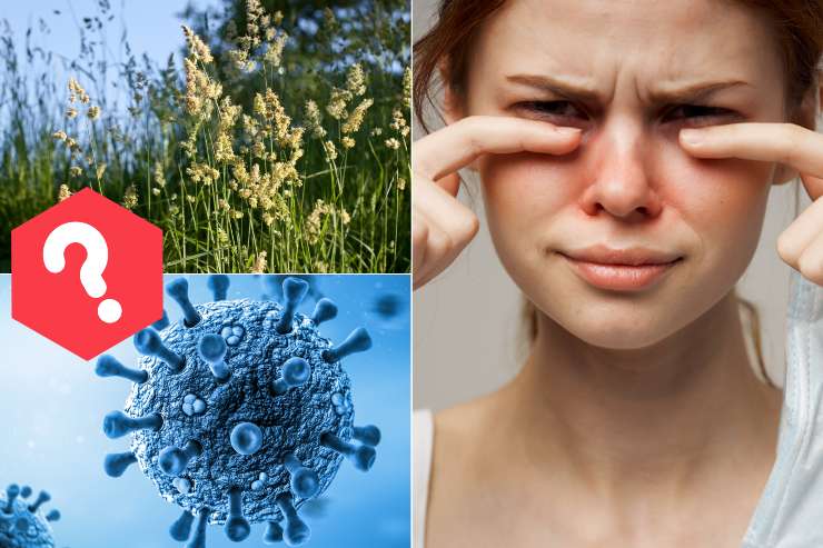 Congiuntivite allergica o virale - Fonte AdobeStock