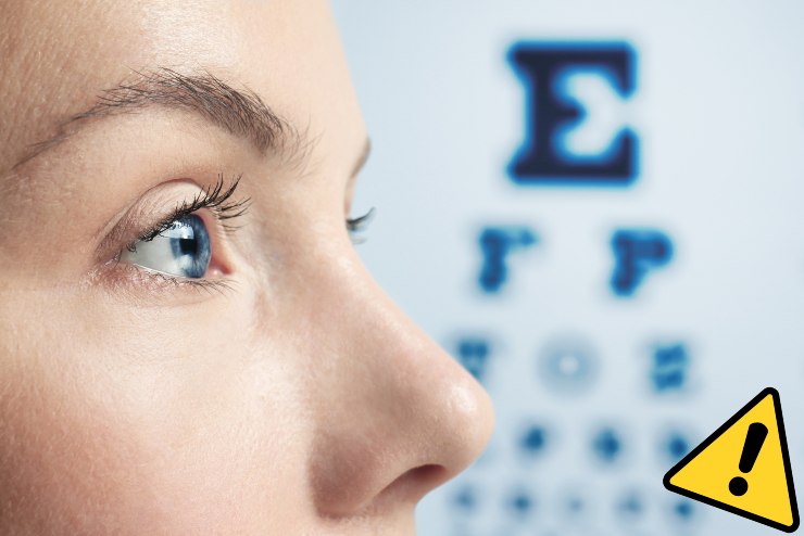 Cos'è l'astigmatismo - Fonte AdobeStock