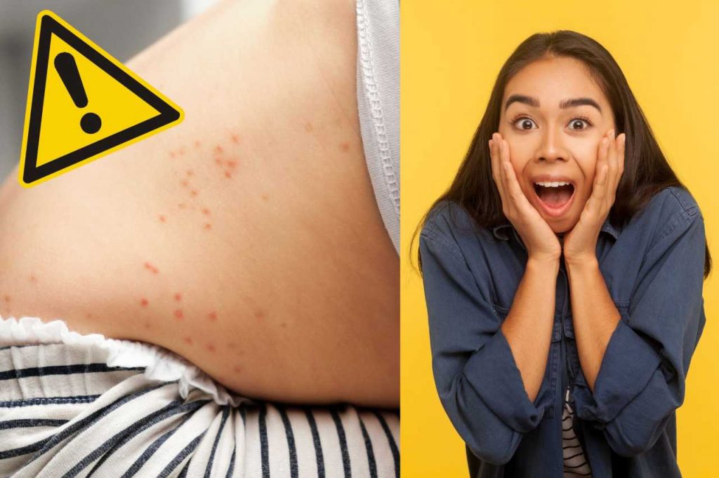Epidemia di scarlattina - Fonte AdobeStock
