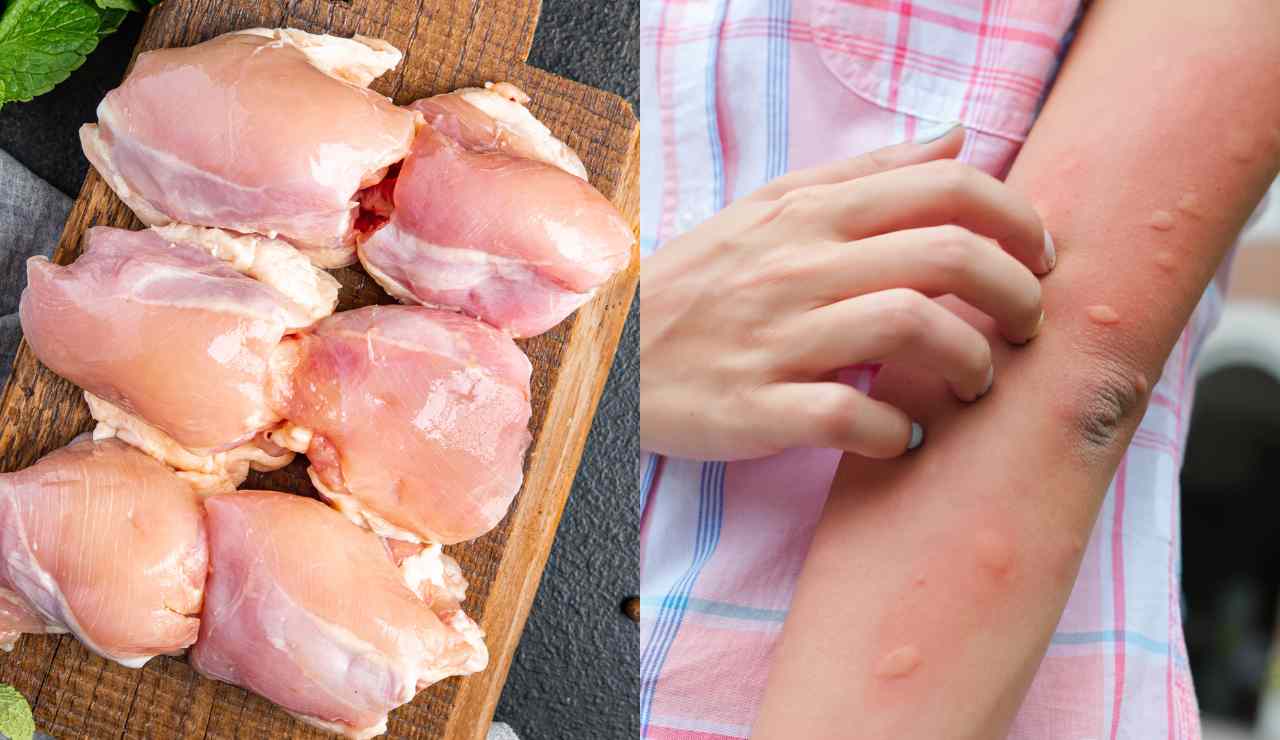 Allergia al pollo - Fonte AdobeStock