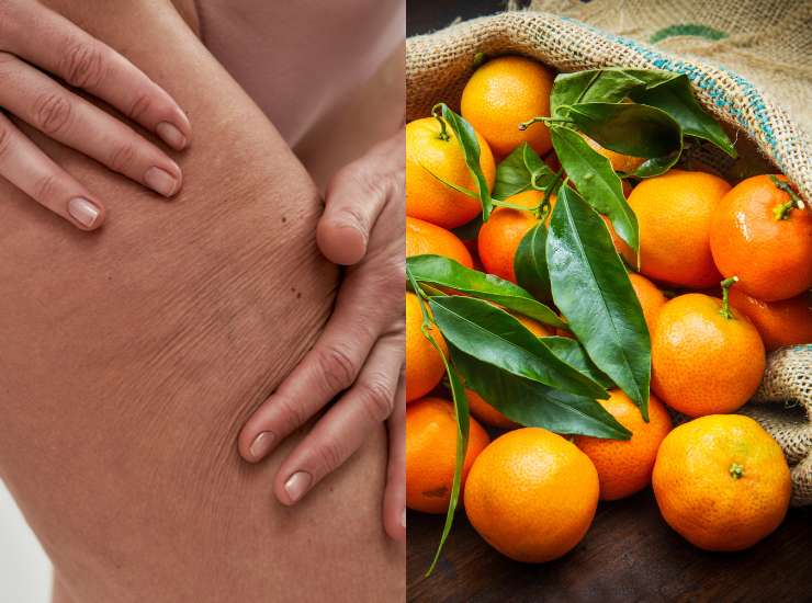 Buccia di mandarini per la cellulite - Fonte AdobeStock