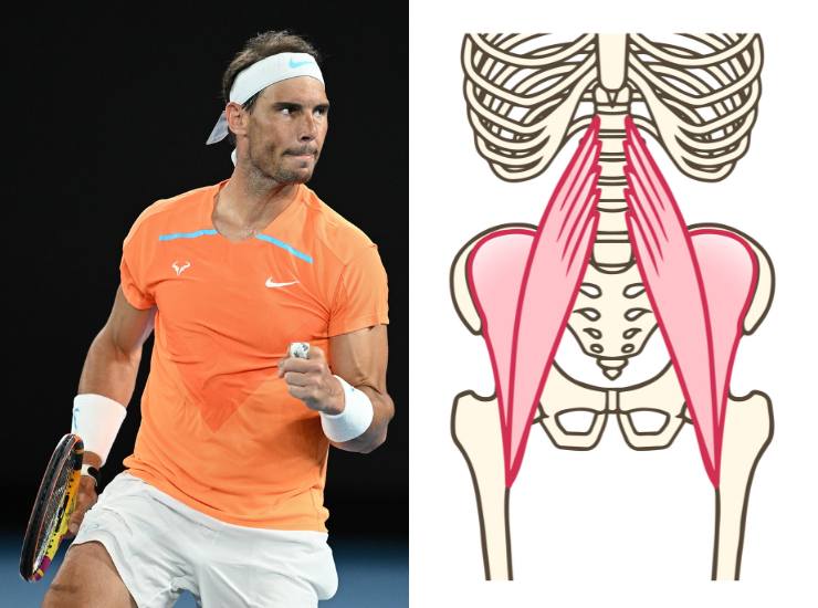 Infortunio di Rafael Nadal all'ileo-psoas - Fonte AdobeStock