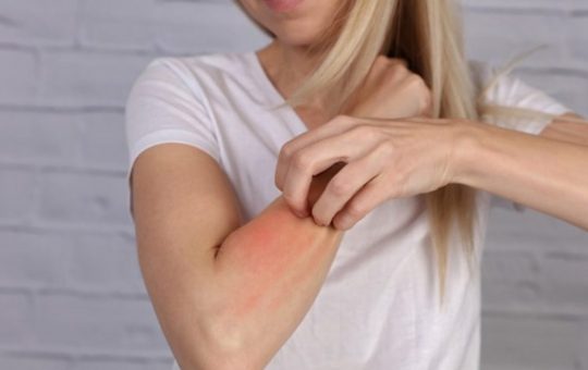 Orticaria da Stress